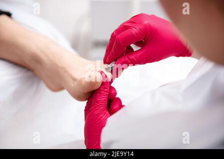 Primo piano di una procedura medico pedicure. Mani pocologiste con strumento tagliaunghie. Foto Stock
