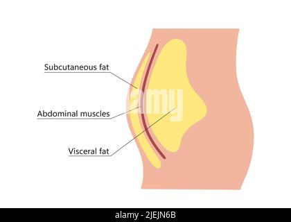 Grasso viscerale e sottocutaneo intorno alla linea della vita. Posizione del grasso viscerale nella cavità addominale. Tipi di obesità umana. Schema medico. Vettore Illustrazione Vettoriale