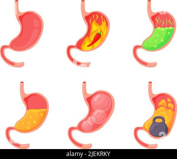 Stomaco vuoto e pieno. Gonfiore mal di stomaco, dolore del tratto digestivo pienezza pesantezza stomaci, acido bruciore di stomaco processo indigestione reflusso duodeno, illustrazione vettoriale della salute dello stomaco e gonfiore Illustrazione Vettoriale