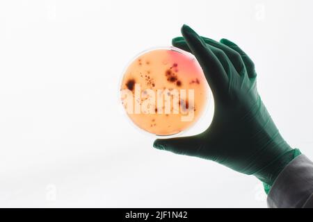 Primo piano di un microbiologo irriconoscibile in guanti verdi che tengono la piastra Petri contro lo schermo luminoso mentre si lavora con un campione di batteri Foto Stock
