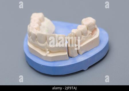 primo piano della denizione artiale pronta per l'uso sul banco da lavoro da laboratorio odontoiatrico Foto Stock