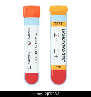 Provetta per campioni di sangue per il test del virus Monkeypox. Test positivo o negativo. Sistemi di test Illustrazione Vettoriale