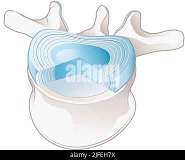Illustrazione che mostra vertebre lombari e dischi intervertebrali sani. Illustrazione etichettata Foto Stock