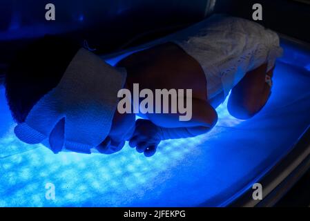 Neonato sdraiato sul letto luminoso per fototerapia a LED per il trattamento dell'ittero Foto Stock