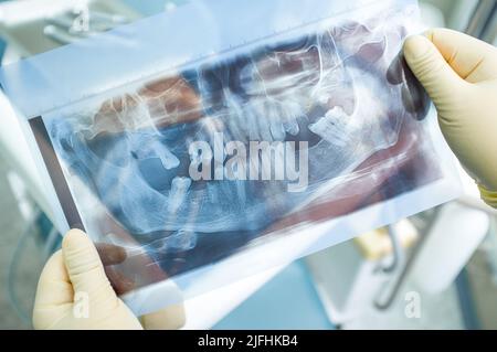 Immagine panoramica a raggi X dei denti umani Foto Stock
