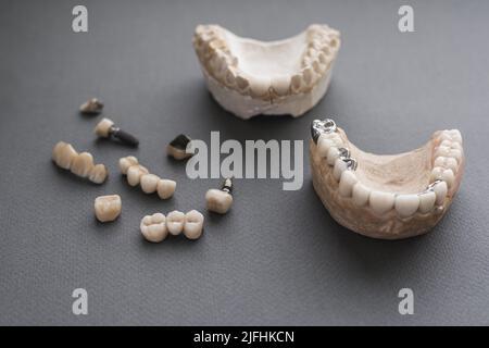 Protesi dentaria pratica materiali primo piano Foto Stock