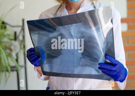 Medico che tiene in mano la fotografia radiografica dei polmoni Foto Stock