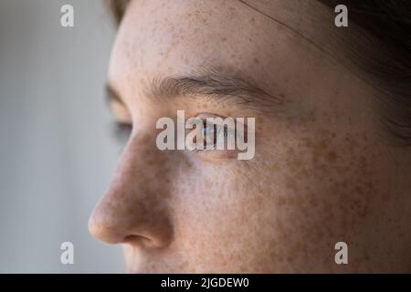 Vista laterale faccia di freckled seria donna pensiva che staring da parte Foto Stock