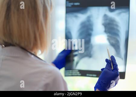 Medico femminile pulmonologista tenendo in mano la fotografia a raggi X dei polmoni Foto Stock