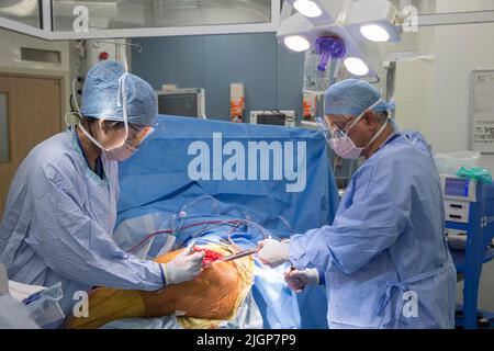 Un chirurgo e un personale NHS effettuano la chirurgia del ginocchio, anche nota come artroplastica, in un ospedale NHS. Foto Stock