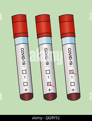 Provette con analisi del paziente. Set vettoriale. Diagnosi di campioni di sangue per l'infezione da coronavirus. Tre risultati positivi, negativi, non preparati. Illustrazione Vettoriale