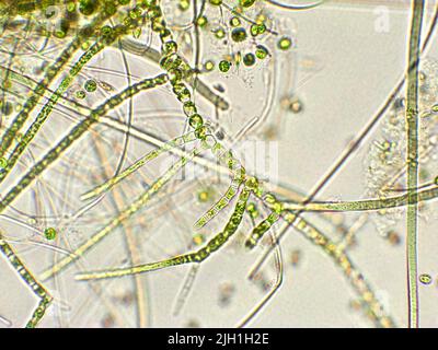 Alghe verdi sotto la vista microscopica, Chlorophyta Foto Stock