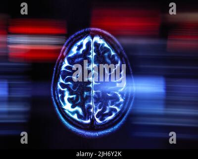 La ricerca di Alzheimer e demenza, immagine concettuale Foto Stock