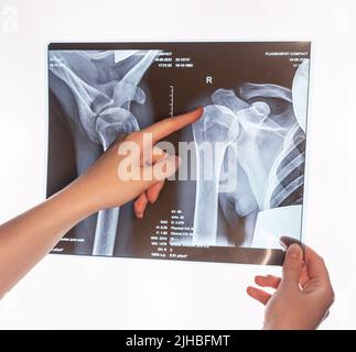 Indice puntato al trauma alla spalla, immagine a raggi X della clavicola. Acromion, frattura terminale acromiale. Lesioni al braccio. Assistenza sanitaria, esame medico concetto. Rilevamento di ossa rotte. Foto di alta qualità Foto Stock