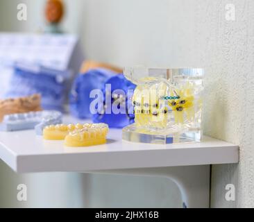 Modello dentale della mandibola con bretelle metalliche e filo Foto Stock