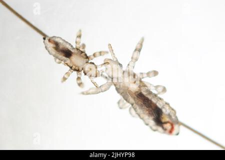 Foto reale dei pidocchi della testa. Louse testa per adulti con louse testa in nymfa su capelli umani su sfondo bianco. Pediculus capitis Foto Stock