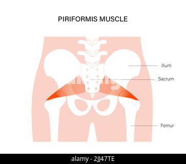 Piriformis muscolo, illustrazione. Foto Stock