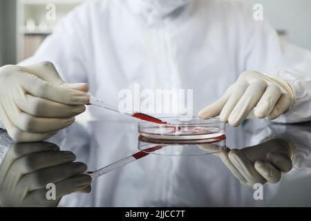 Vista ad angolo elevato dello scienziato che indossa l'equipaggiamento protettivo completo durante l'esecuzione di esami del sangue in piastra Petri presso il laboratorio medico Foto Stock