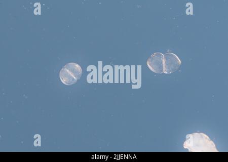 Comune fiume mussel, comune centrale europeo fiume mussel (Unio crassus), glochidia, Germania Foto Stock