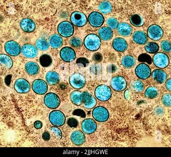 Fort Detrick, Stati Uniti. 26th luglio 2022. Una micrografia elettronica a trasmissione colorata di particelle di virus della scimmia-pox (teal) che si trovano all'interno di una cellula infetta (marrone) coltivata in laboratorio e catturata presso la NIAID Integrated Research Facility rilasciata il 26 luglio 2022, a Fort Detrick, Maryland. Credit: NIAID/NIAID/Alamy Live News Foto Stock