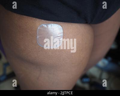 HRT Patch sulla coscia di una donna di colore Foto Stock