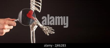 Banner con mano con lente di ingrandimento sulle ossa del gomito dello scheletro umano con punta rossa. Umero, raggio, ulna. Dolore al braccio, concetto di studio anatomico. Spazio di copia. Foto di alta qualità Foto Stock