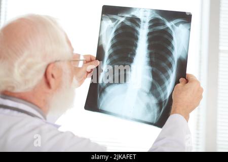 Vista sulla spalla del medico senior che esamina l'immagine radiologica del torace Foto Stock