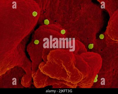 Micrografia elettronica a scansione di particelle (gialle) del virus della febbre emorragica Crimea-Congo che germogliano dalla superficie di cellule epiteliali coltivate di un paziente. Credito: NIAID Foto Stock