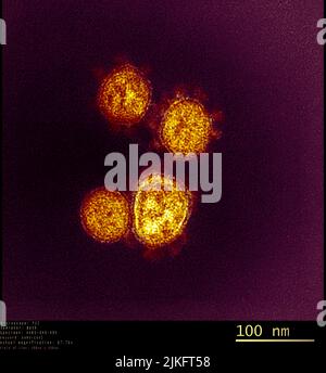 Questa immagine al microscopio elettronico a trasmissione mostra SARS-COV-2 anche noto come 2019-nCoV, il virus che causa COVID-19. Le particelle di virus emergono dalla superficie di una cellula coltivata in laboratorio. I picchi sul bordo esterno delle particelle virali danno il loro nome ai coronavirus, a forma di corona. Immagine catturata e colorata presso i Rocky Mountain Laboratories di Hamilton, Montana. Credito: NIAID Foto Stock