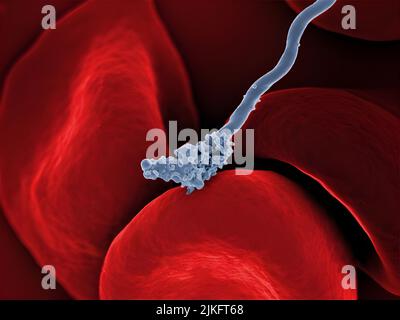 Micrografia elettronica a scansione di Borrelia hermsii, l'agente causale della febbre recidivante, che interagisce con i globuli rossi. Foto Stock