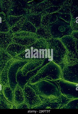 Ebola virus isolato nel novembre 2014 da campioni di sangue di pazienti ottenuti in Mali. Il virus è stato isolato su cellule vero. Foto Stock