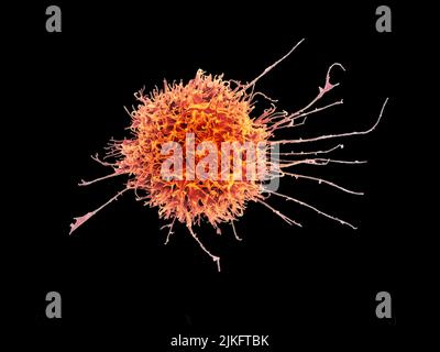 Micrografia elettronica a scansione colorata di una cellula killer naturale di un donatore umano. Foto Stock