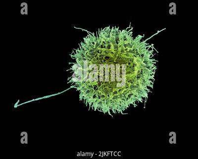 Micrografia elettronica a scansione colorata di una cellula killer naturale di un donatore umano. Foto Stock