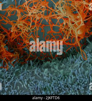 Ebola virus isolato nel novembre 2014 da campioni di sangue di pazienti ottenuti in Mali. Il virus è stato isolato su cellule vero. Foto Stock