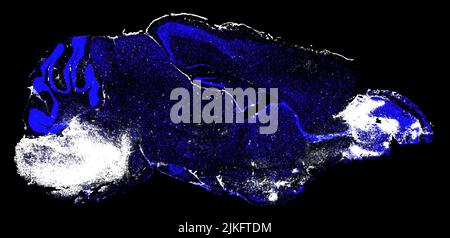 Utilizzando una tecnologia di imaging cerebrale all'avanguardia, gli scienziati dei National Institutes of Health hanno girato ciò che sta accadendo nel cervello dei topi che hanno sviluppato la malaria cerebrale (CM). I risultati, pubblicati in PLOS pathogens, hanno prodotto i processi che portano all'esito fatale della malattia e la rapida terapia anticorpale che potrebbe trattarla. Foto Stock