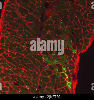 Muscolo diaframmatico da un topo carente di distrofina trattato con SU9516 nuclei (blu), miofibre (scatolato in rosso) e fibre muscolari rigeneranti (verde). Foto Stock