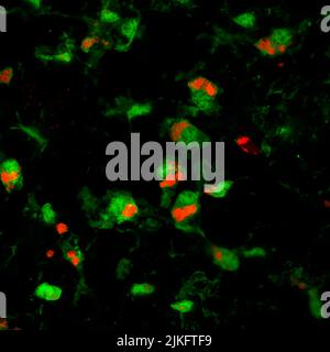 Microglia, un tipo di cellula del sistema nervoso precedentemente sospettato di causare danno retinico, è stato dimostrato essere utile nel rallentare la progressione della malattia del prione nel cervello, e ora nella retina. In questa immagine, le cellule microgliali (verdi) ingulcano e rimuovono i fotorecettori danneggiati dal prione (rossi), che sembrano rallentare la degenerazione retinica. Foto Stock