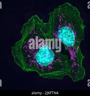 Queste cellule tumorali della pelle mostrano da un topo, un animale comunemente usato per studiare le malattie umane (compresi molti tipi di cancro) e per testare l'efficacia dei farmaci. Le due cellule qui contenute sono collegate da actina (verde), una proteina di scheletro cellulare. Anche se l'actina è richiesta da molte cellule per il movimento normale, inoltre permette che le cellule del cancro si diffondano ad altre parti del corpo. Foto Stock