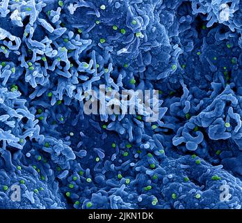 Monkeypox Virus Colorizzato trasmissione elettrone micrografia di particelle di scimmipox trovato all'interno di una cellula infetta, coltivato in laboratorio. Immagine catturata e resa cromatica migliorata presso il NIAID Integrated Research Facility (IRF) di Fort Detrick, Maryland. Credito: NIAID Foto Stock