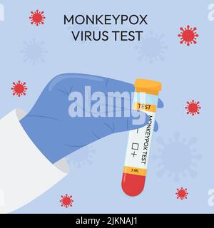 La mano di un medico in un guanto protettivo contiene una provetta. Test del virus Monkeypox. Test positivo o negativo. Sistemi di test. Illustrazione Vettoriale