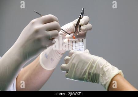 Il dermatologo preleva campioni da una talpa sospetta. Foto Stock