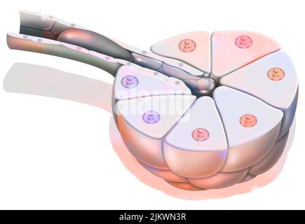 Zoom di un acino pancreatico e del suo dotto bloccato. Foto Stock