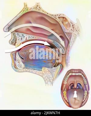 Vie aeree (nasofaringe) nei russatori: Diminuzione del tono muscolare. Foto Stock