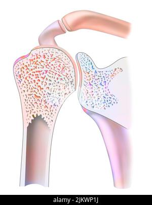 Sezione sagittale media di un'articolazione sana della spalla. Foto Stock