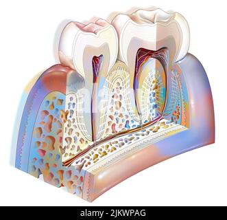 Placca dentale: Principali patologie dei denti: Tartaro, gengivite. . Foto Stock