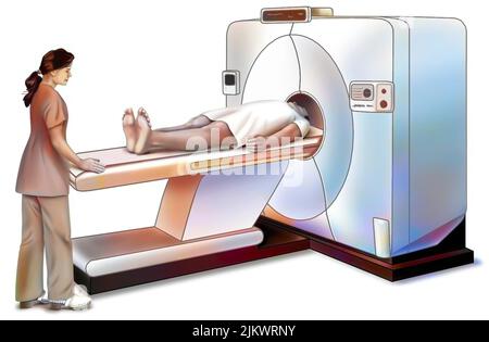 Scansione PET: Dispositivo di imaging medicale per rilevare tumori e metastasi. Foto Stock