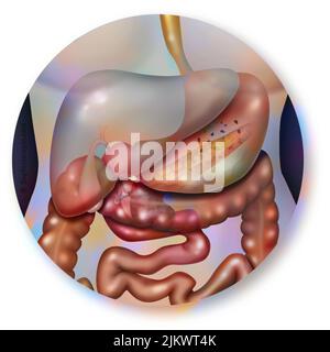 Fegato e il suo contributo con gli organi vicini: Stomaco, intestino. Foto Stock