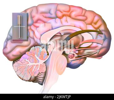 Desiderio e rottura (stato 1): Reazione del cervello alla nascita del desiderio di amore. Foto Stock