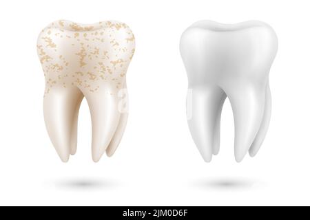 Denti sbiancanti concetto 3D. Confronto tra denti puliti e sporchi prima e dopo il trattamento di sbiancamento. Procedura di sbiancamento dei denti, poster sulla salute dentale Illustrazione Vettoriale