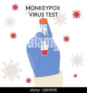 La mano di un medico in un guanto protettivo contiene una provetta. Test del virus Monkeypox. Test positivo o negativo. Sistemi di test. Illustrazione Vettoriale